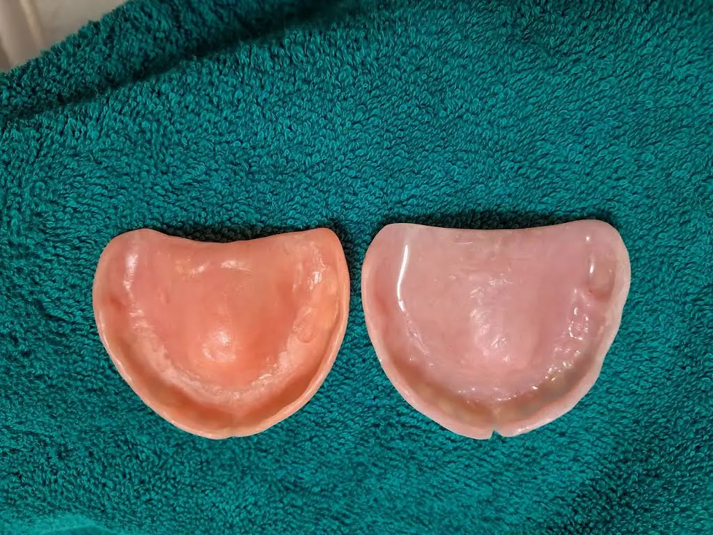 Affordable Dentures & Implants