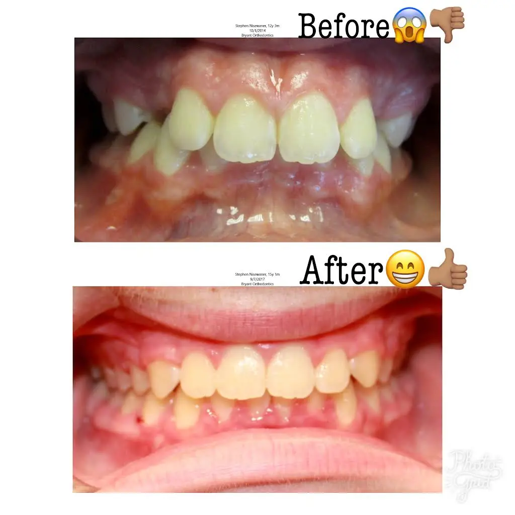 Michael Bryant Orthodontics
