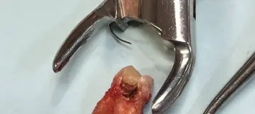 Dental Dreams - Belair