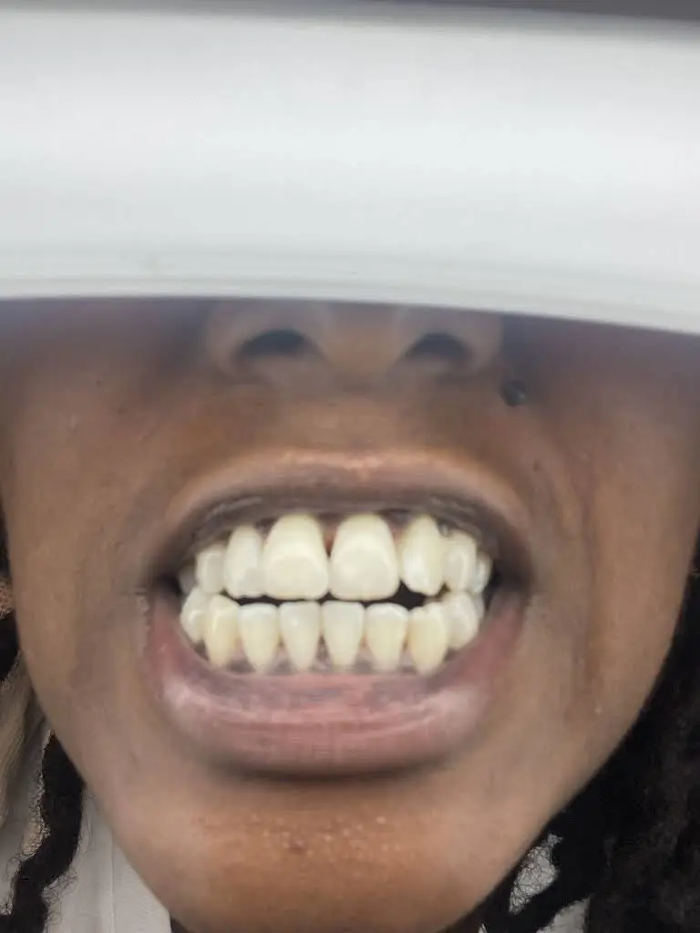 Dental Dreams - Belair