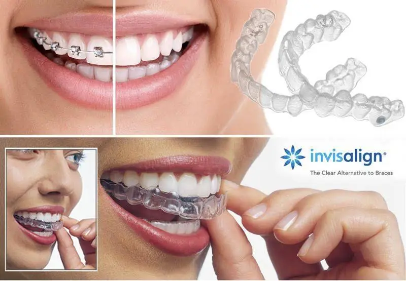Smiles of Sterling Dental Office