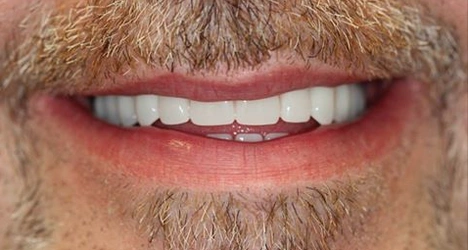 Titan Dental Care