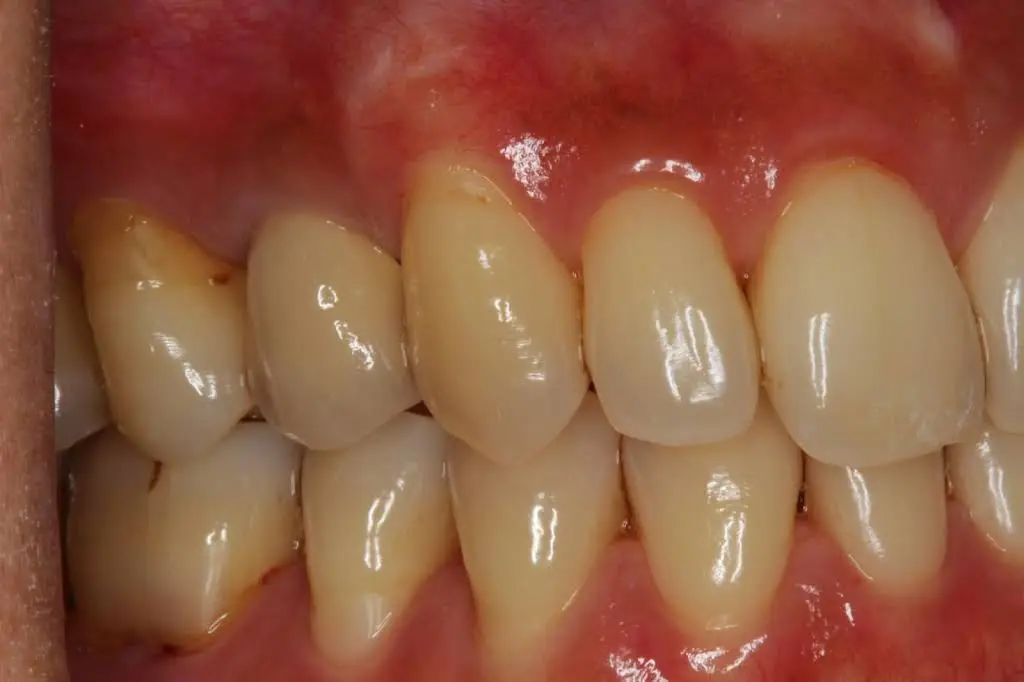 Ridgetop Dental - Sterling