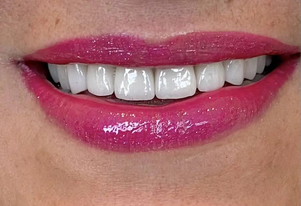 Relaxed Dentistry - Ruben D Cuellar DDS
