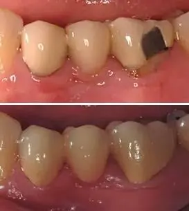 Centreville Dental Group