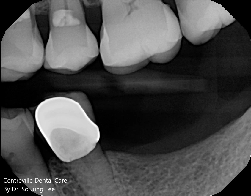Centreville Dental Care