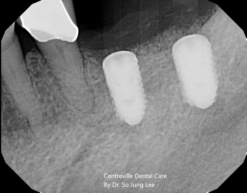 Centreville Dental Care