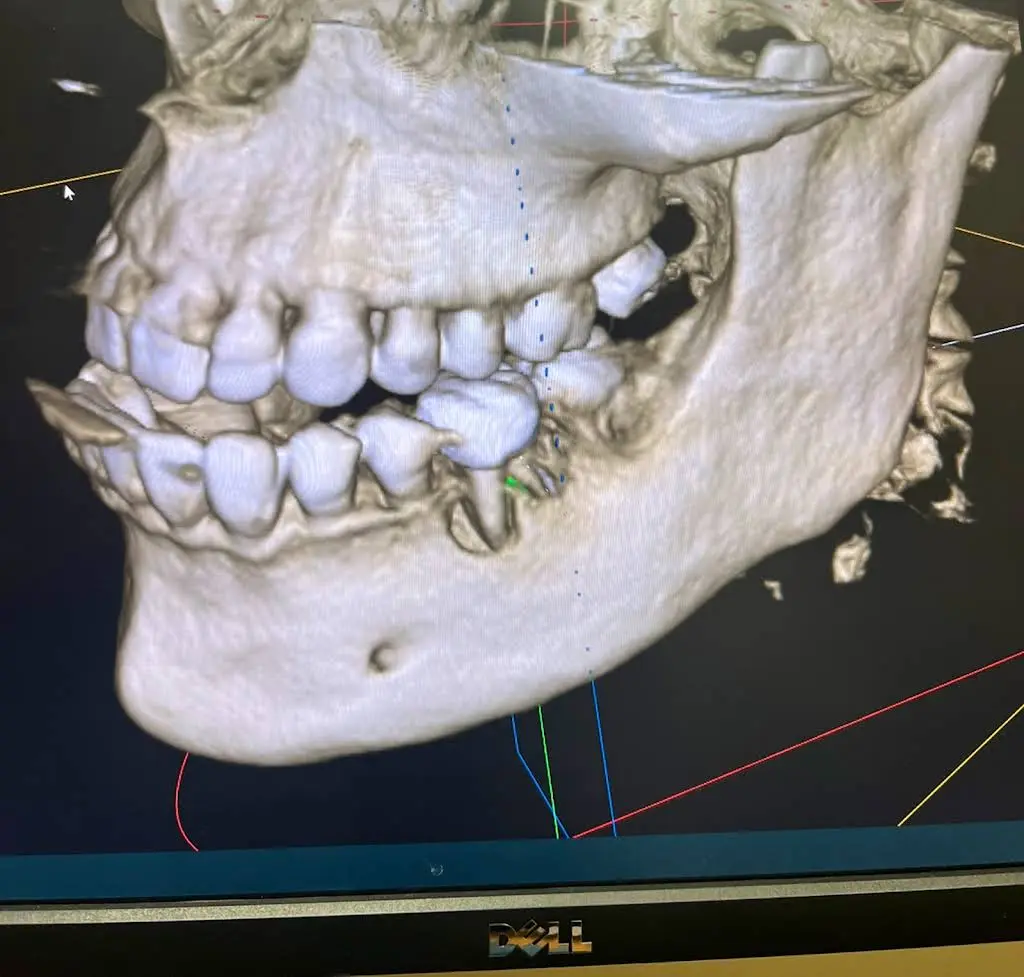 Aspire Oral & Maxillofacial Surgery