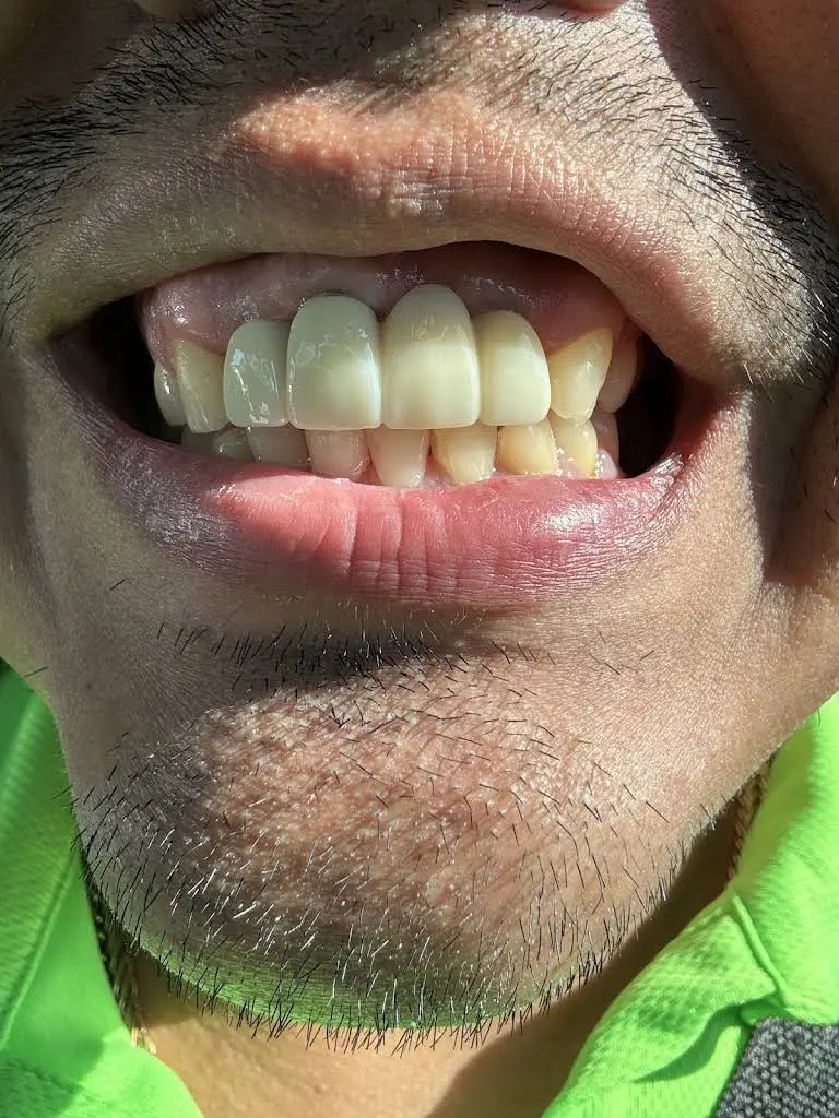 Aspen Dental