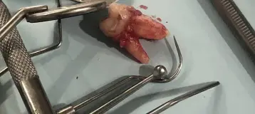 Now Dentistry