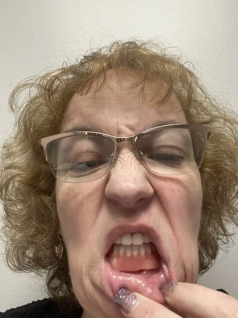 Affordable Dentures & Implants