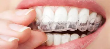 Cascades Dental Care