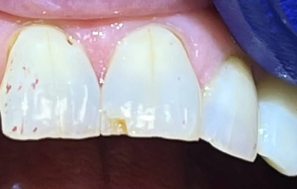 Mosaic Dental Sterling, VA