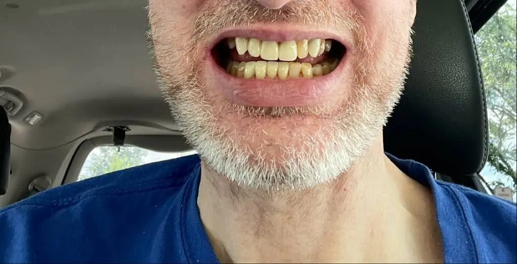 Lake Center Family & Cosmetic Dentistry