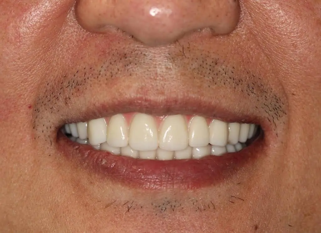 Lake Center Family & Cosmetic Dentistry