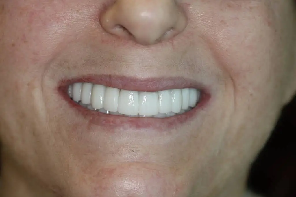 Lake Center Family & Cosmetic Dentistry