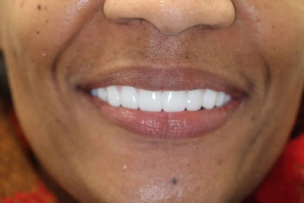 Lake Center Family & Cosmetic Dentistry
