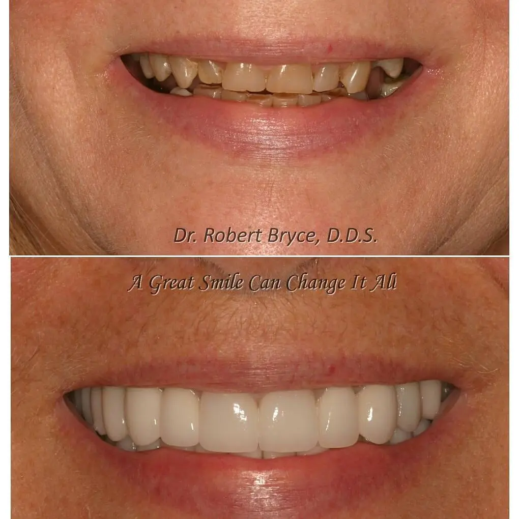 Aesthetic Dentistry By Design: Robert W. Bryce, DDS