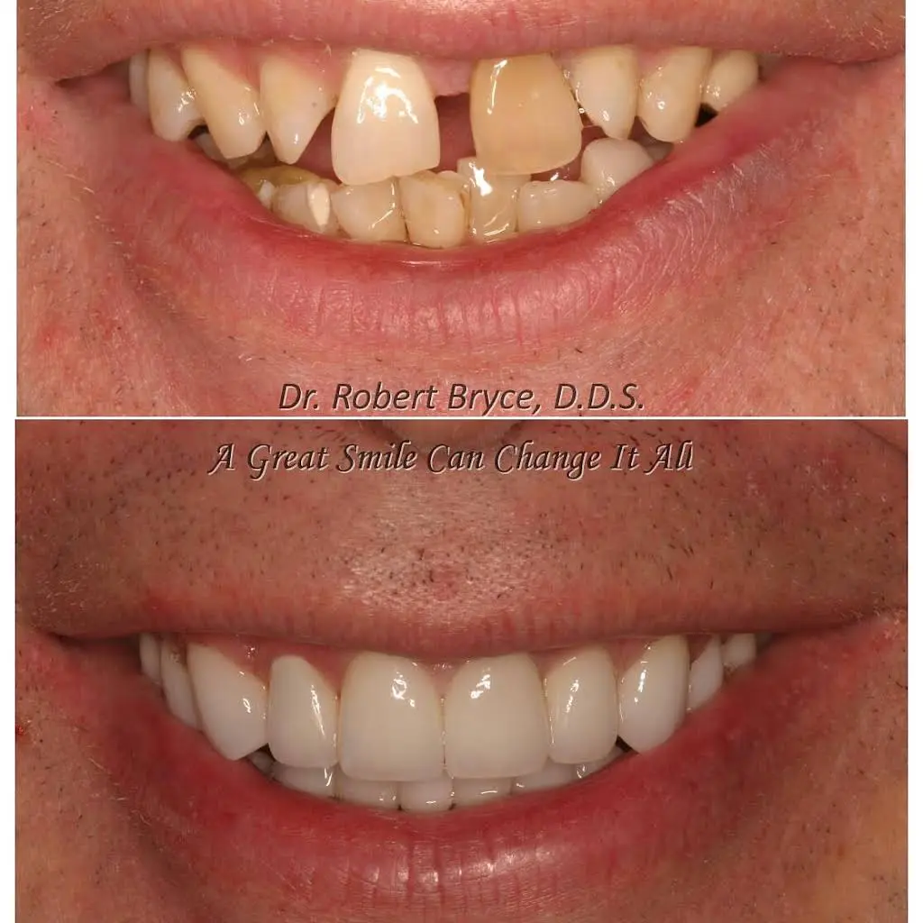 Aesthetic Dentistry By Design: Robert W. Bryce, DDS