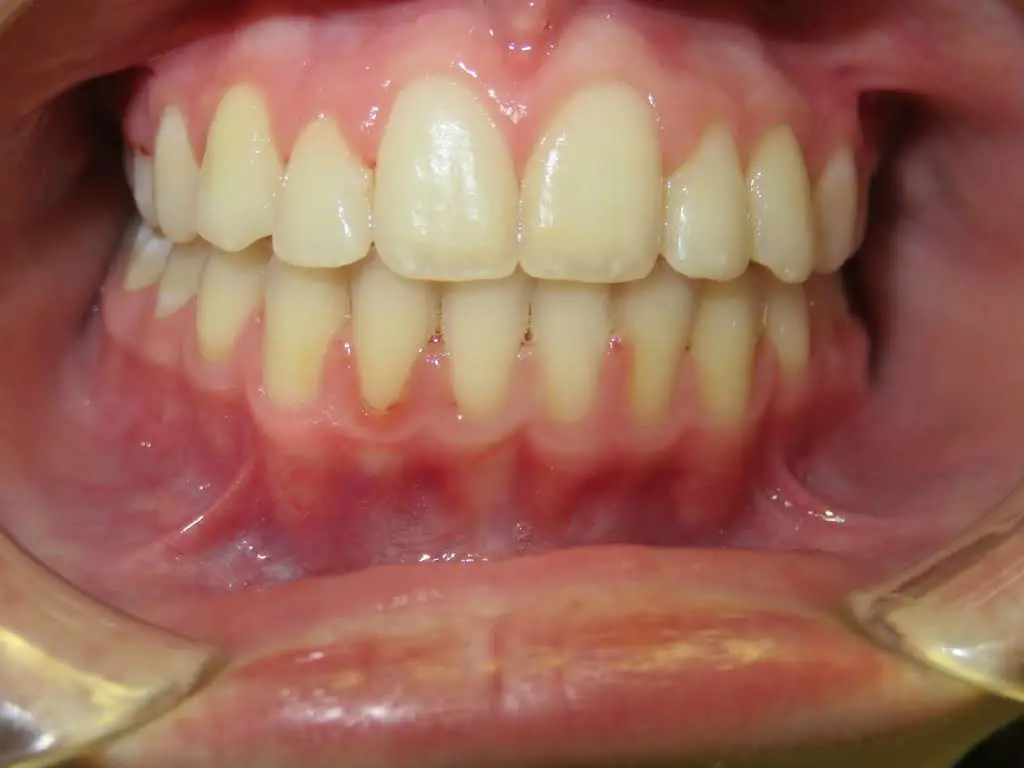 Regal Dental Care - Chantilly VA Office