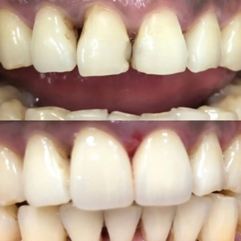 Kay Dental Care