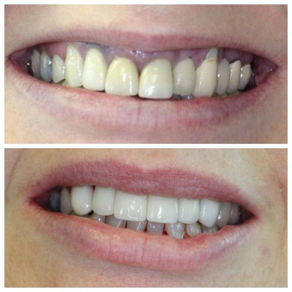 Mequon Smiles