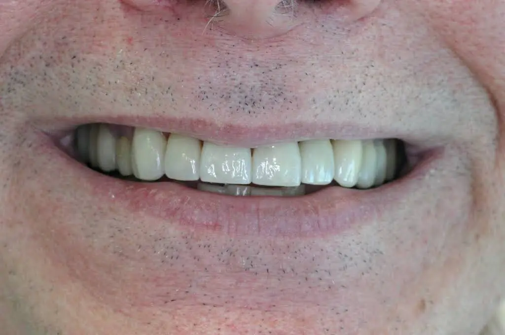 Mequon Smiles