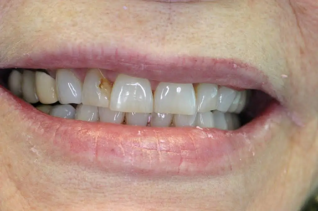 Mequon Smiles