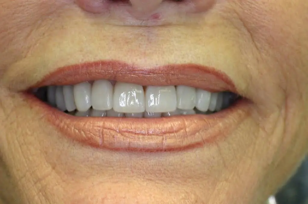 Mequon Smiles