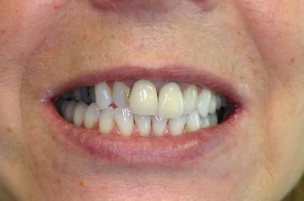 Mequon Smiles