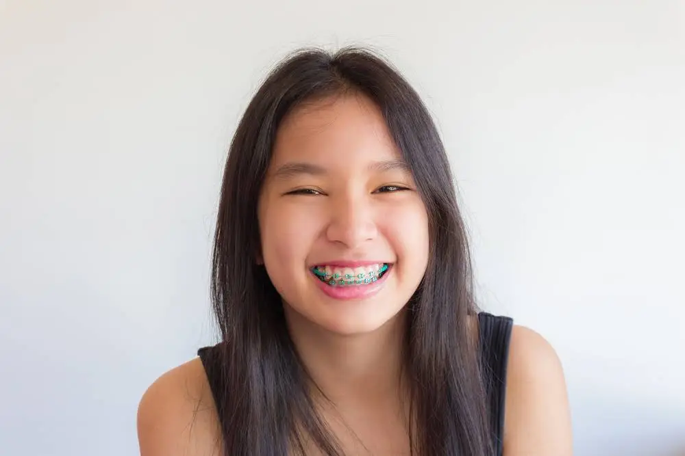 Mequon Smile Design