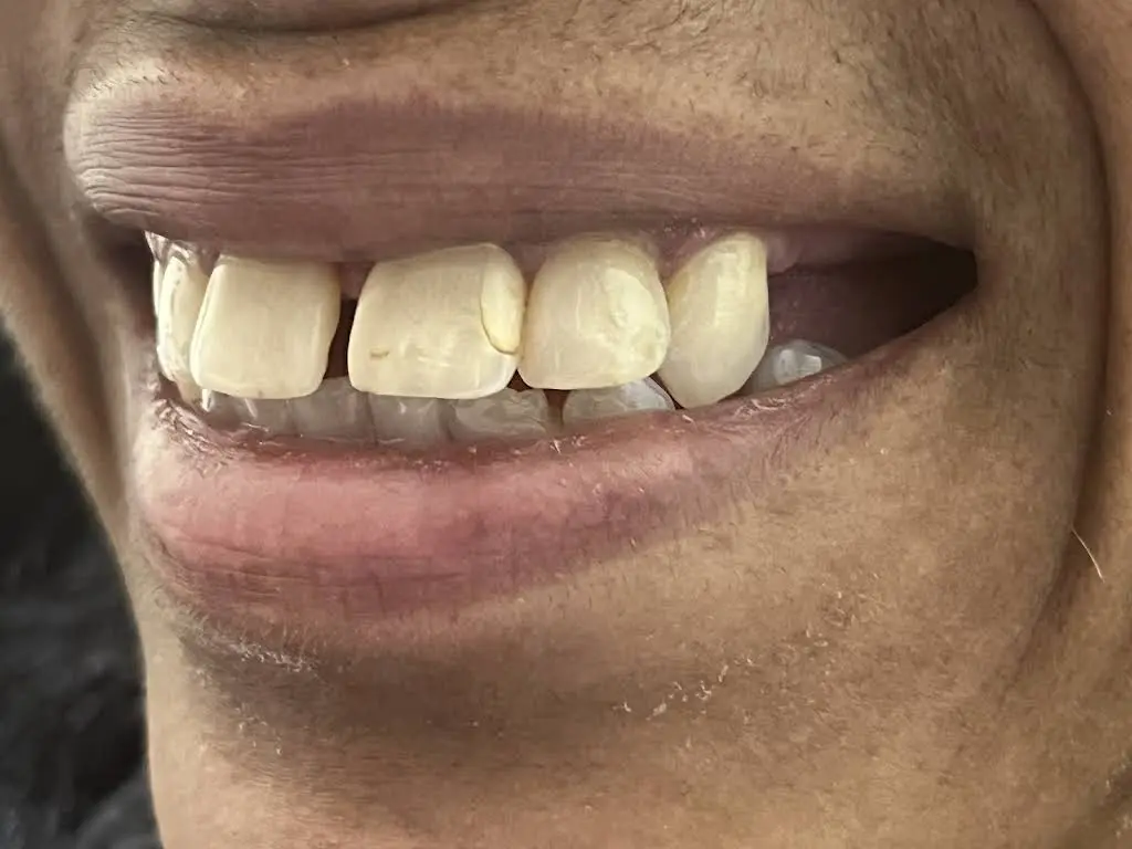 Love Your New Smile - Dr. Peter Diacoloukas