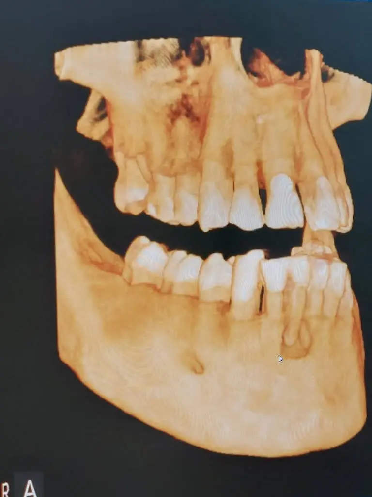 Love Your New Smile - Dr. Peter Diacoloukas