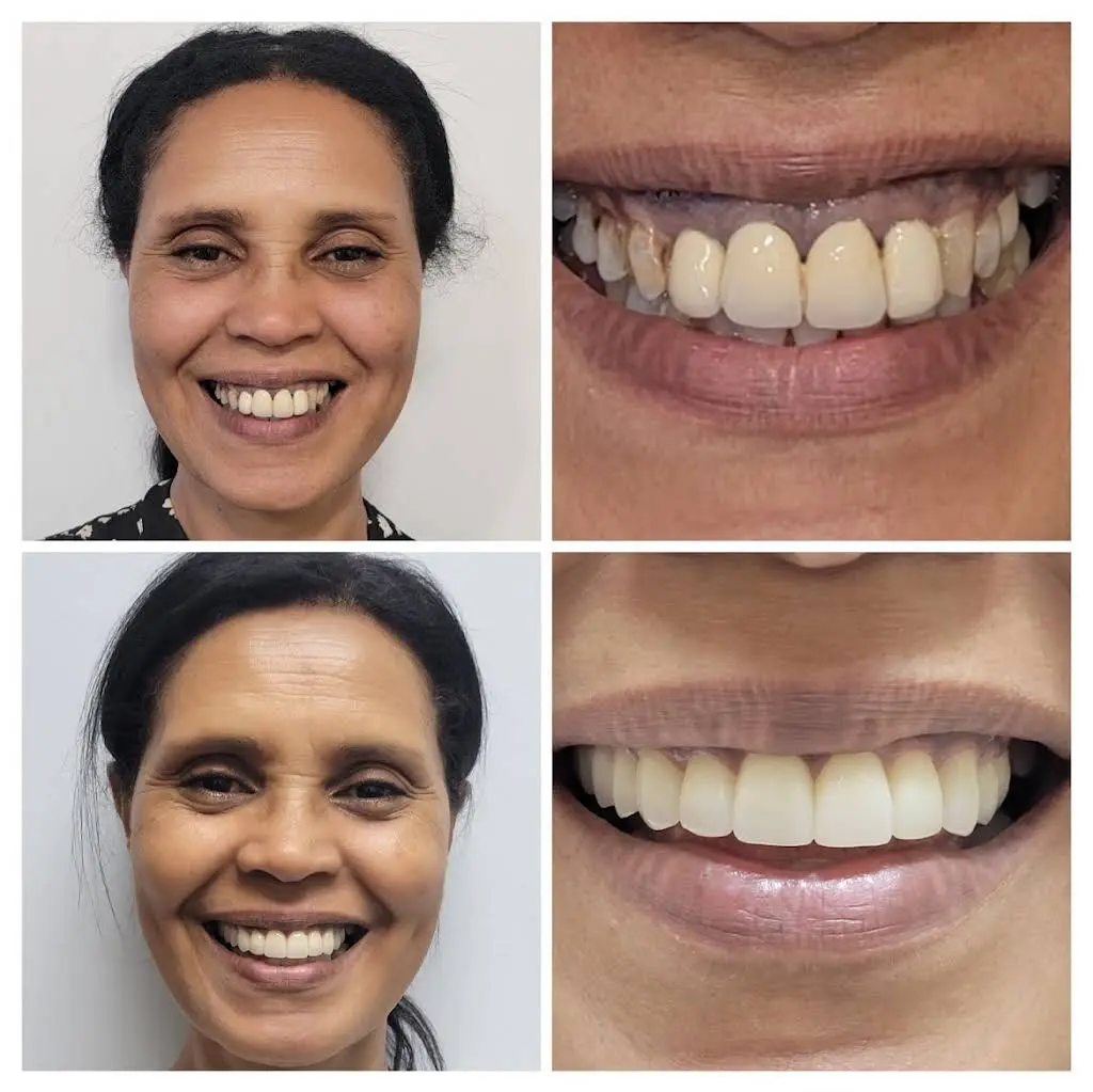 Love Your New Smile - Dr. Peter Diacoloukas