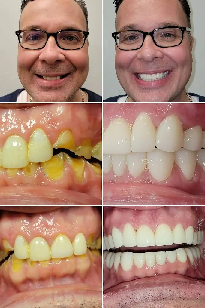 Love Your New Smile - Dr. Peter Diacoloukas