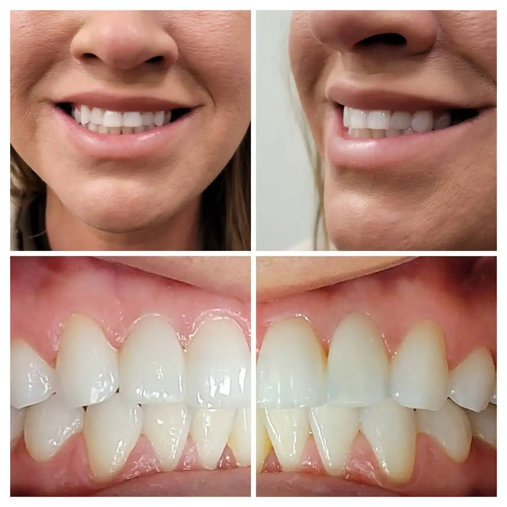 Love Your New Smile - Dr. Peter Diacoloukas