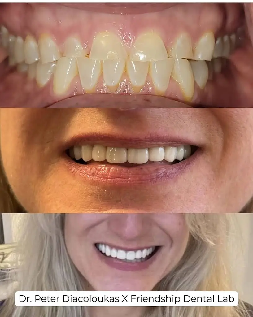 Love Your New Smile - Dr. Peter Diacoloukas