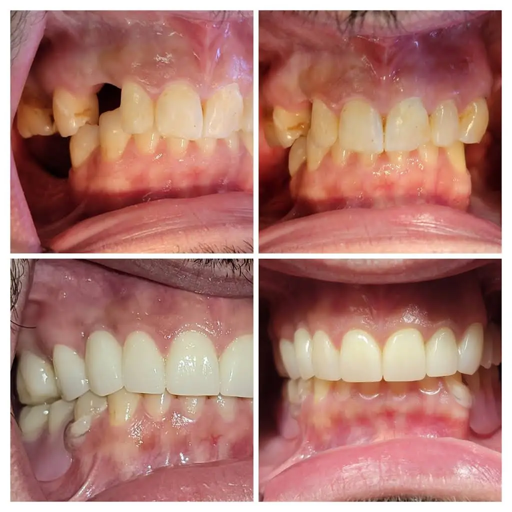 Love Your New Smile - Dr. Peter Diacoloukas