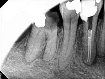 Endodontic Partners