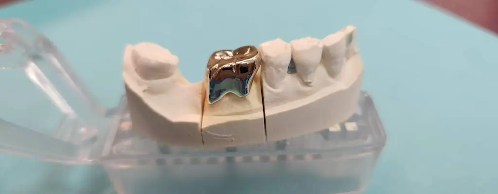 Gentle Dental Care Sterling Virginia
