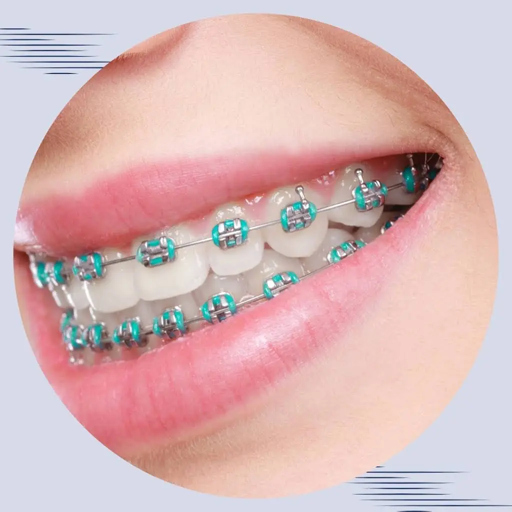 Jones Orthodontics