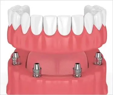 Sweet Smiles Family Dentistry