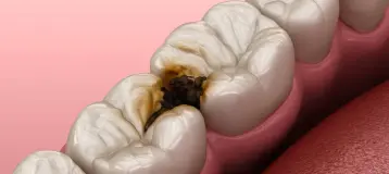 Village Smile Care