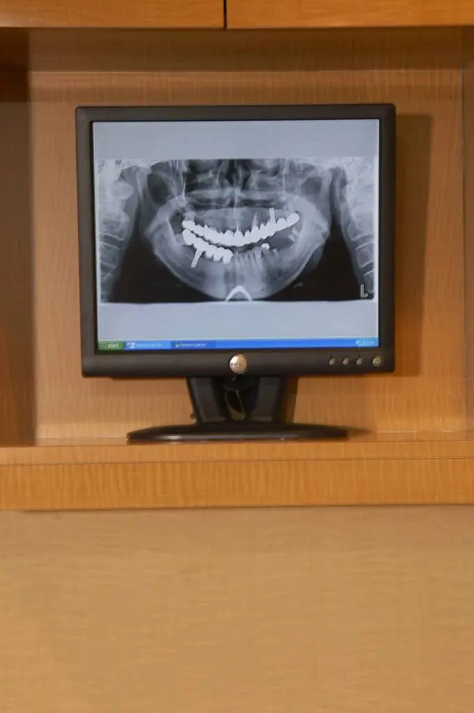 Annapolis Denture Services