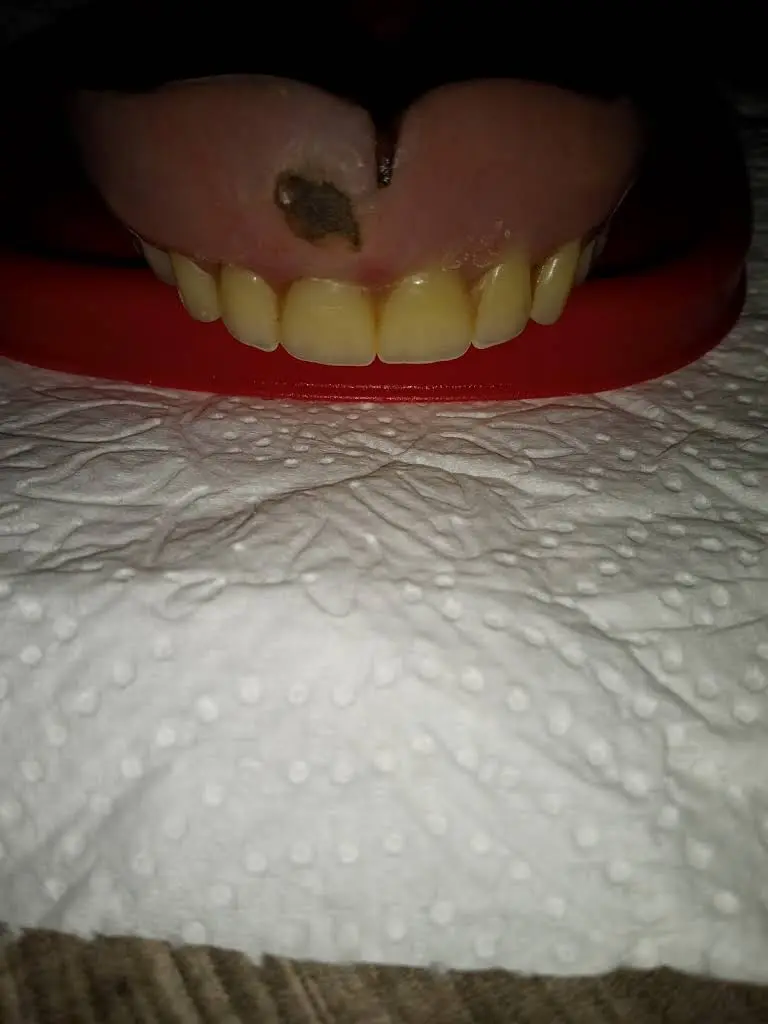 Aspen Dental