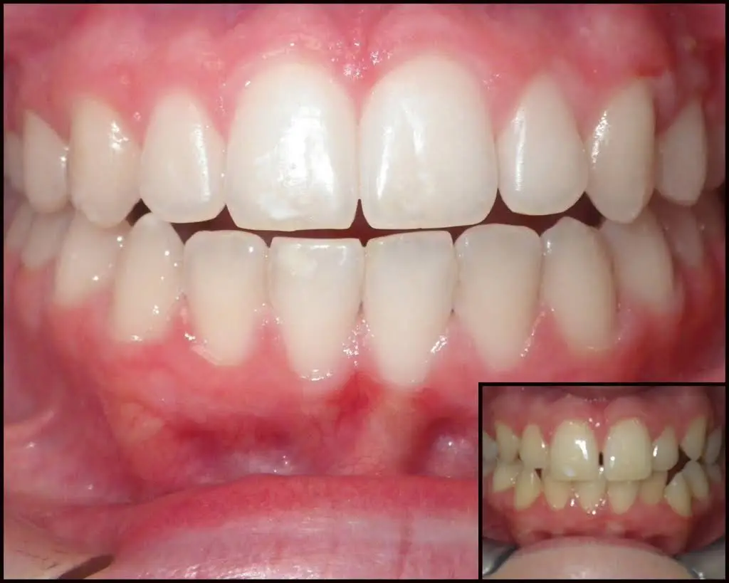 Valley Dental