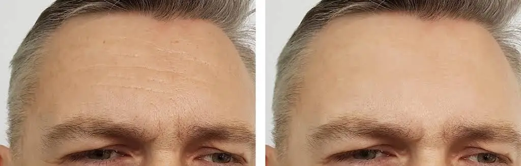 Springville Family Aesthetics & Dentistry - Dr. Bob Miklesh, D.D.S.