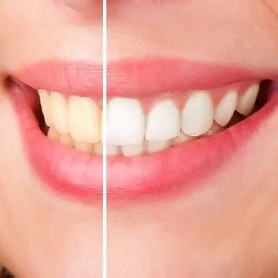 Prime Care Dental