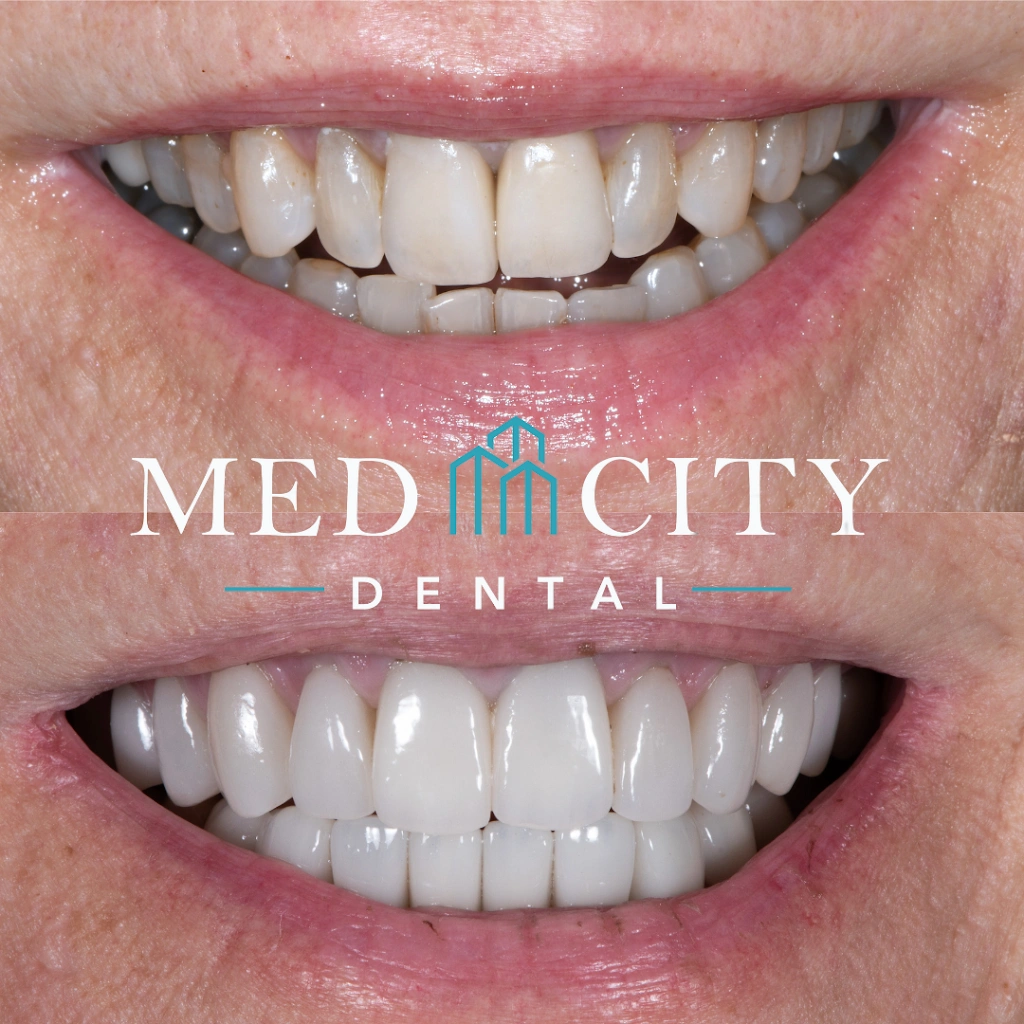 Med City Dental