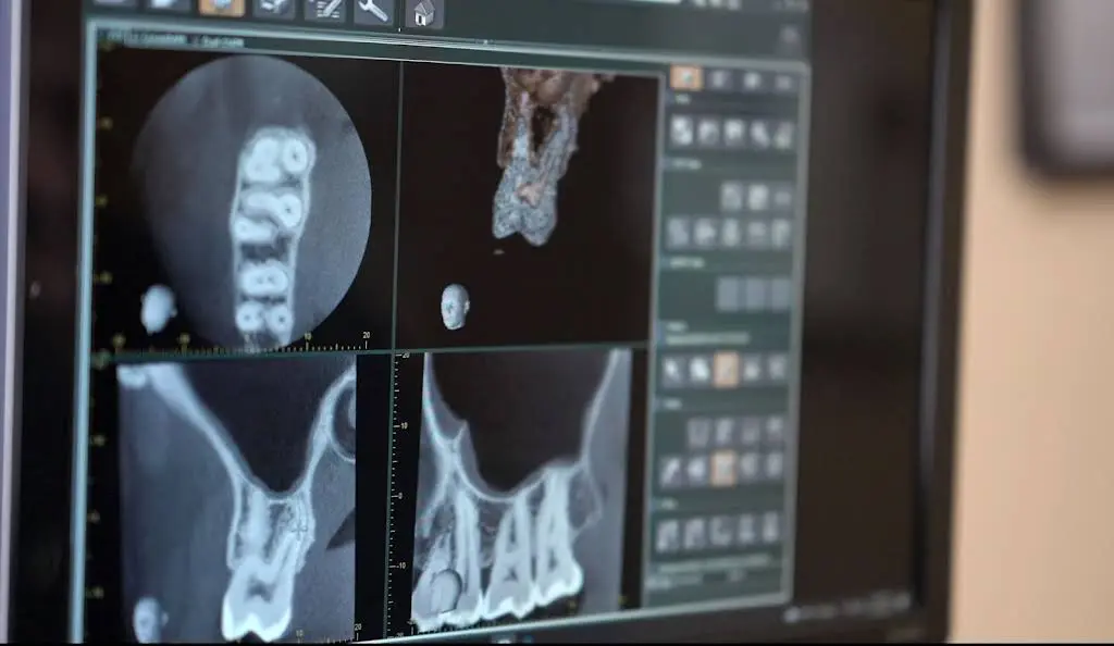 Zumbro Valley Endodontics
